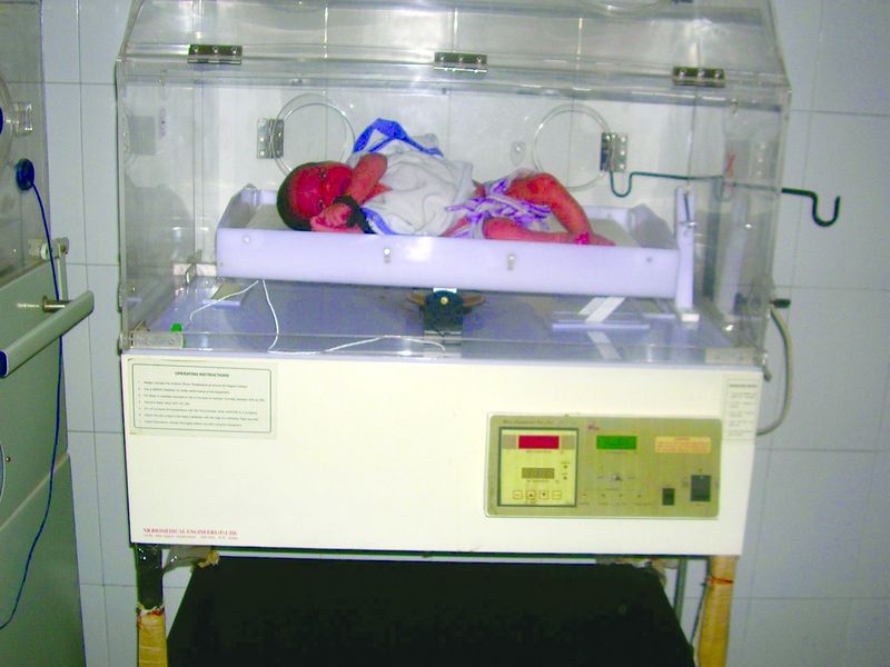 ചിത്രം:Vol3p638 Baby incubator.jpg.jpg