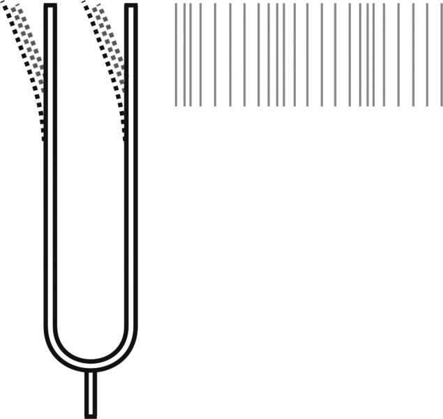 ചിത്രം:Vol6p329 vibration pic 2.jpg