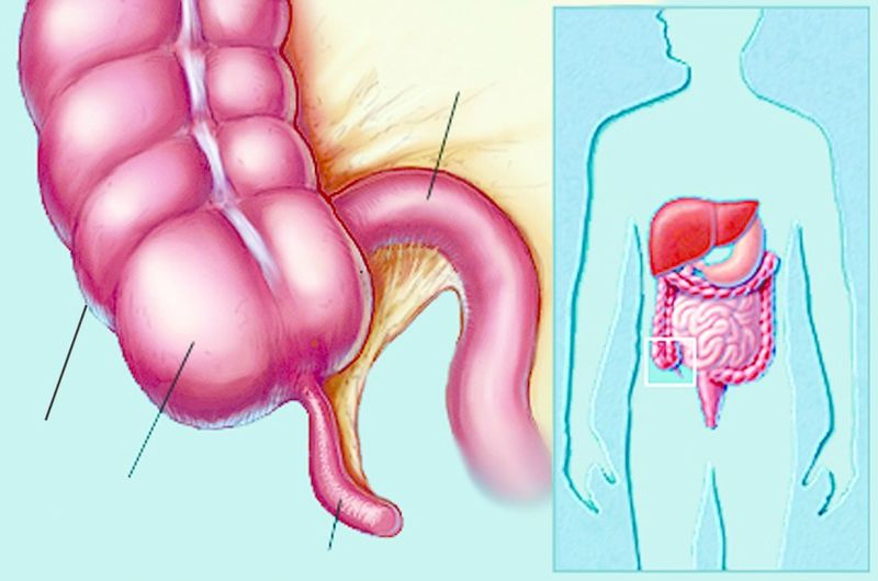 ചിത്രം:Vol4p658 anatomy-appendix.jpg