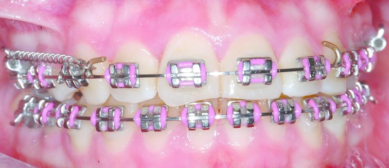 ചിത്രം:Vol5p825 orthodontics.jpg