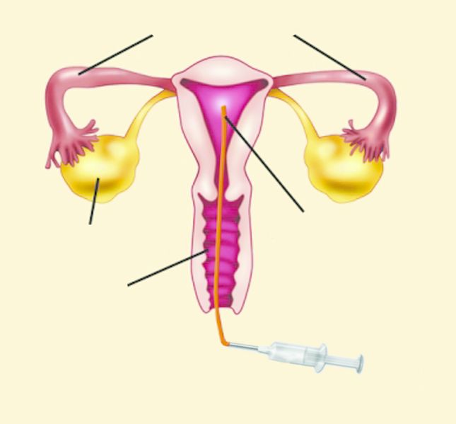 ചിത്രം:Vol7p852 IUI diagram.jpg